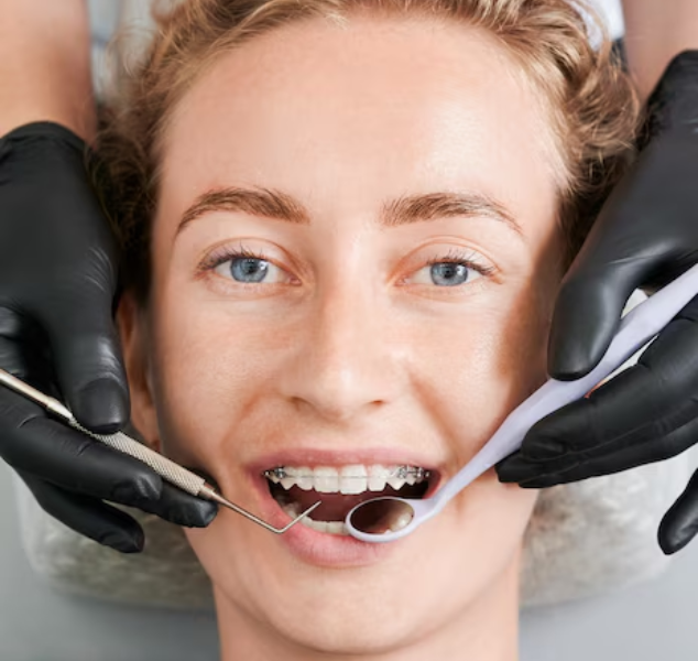 Braces – Orthodontics