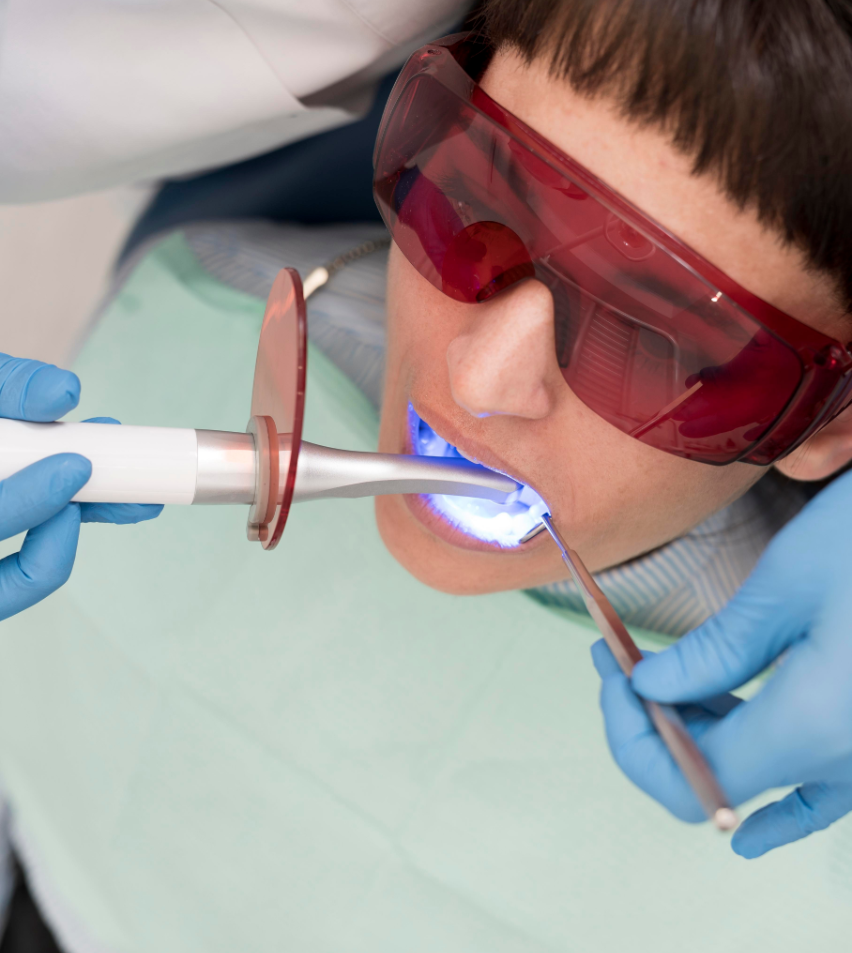 Our Teeth Bleaching Procedure