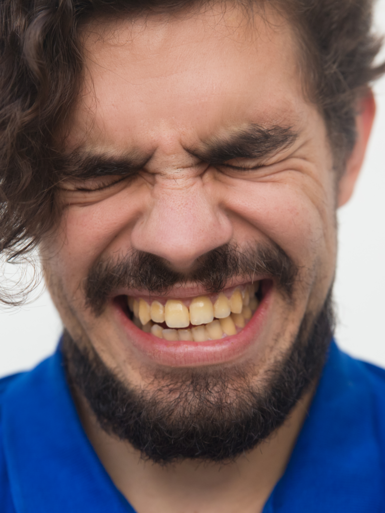 Signs You Need a Tooth Polishing