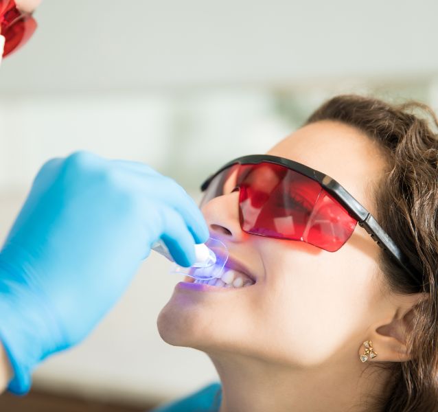 Tooth Polishing