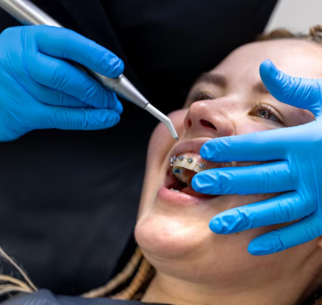 metal-braces -banner