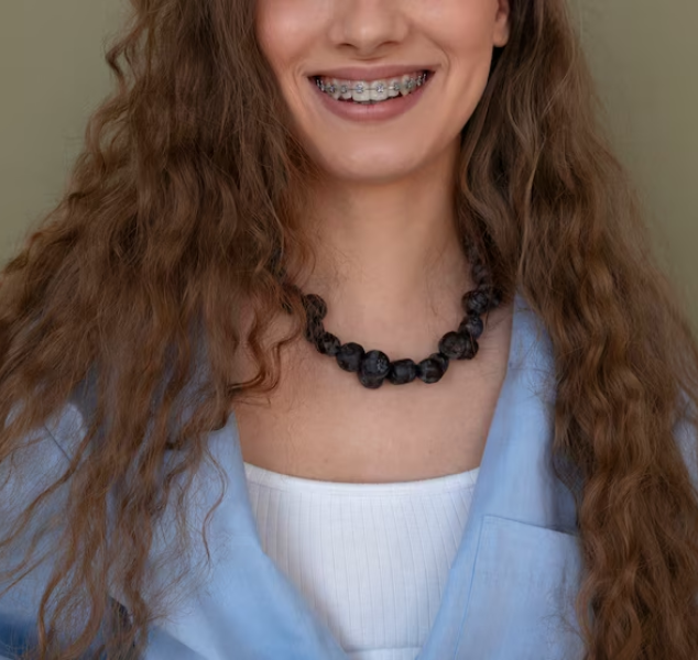metal-braces